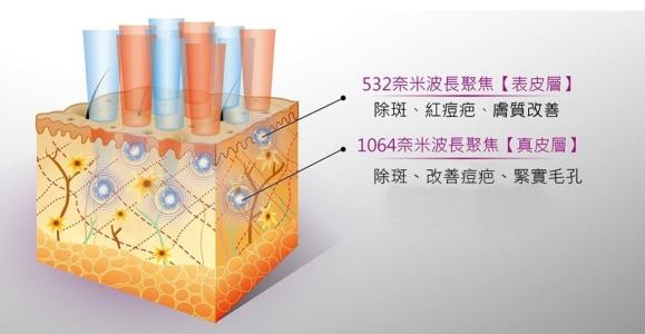 祛痘我用點(diǎn)陣，你呢？！